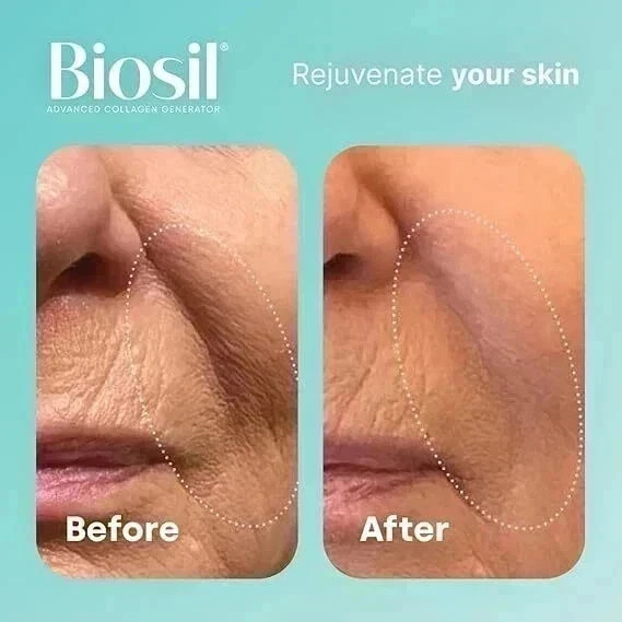 Biosil Collagen Generator – 120 Original Capsules ( pack of 2 )