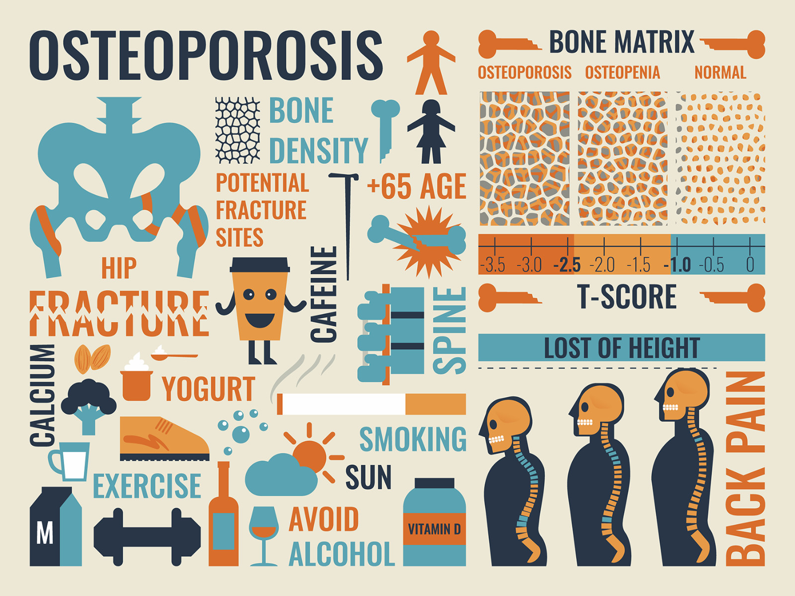 EZorb Calcium (180 Caps) 92% Absorption Bone Spurs Osteoporosis Arthritis Muscle