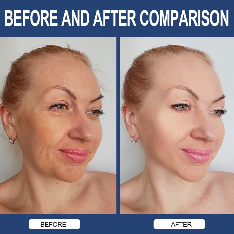 Hyaluronic Acid Anti Aging Hydrating Capsules Wrinkles Fine Lines Joint Health