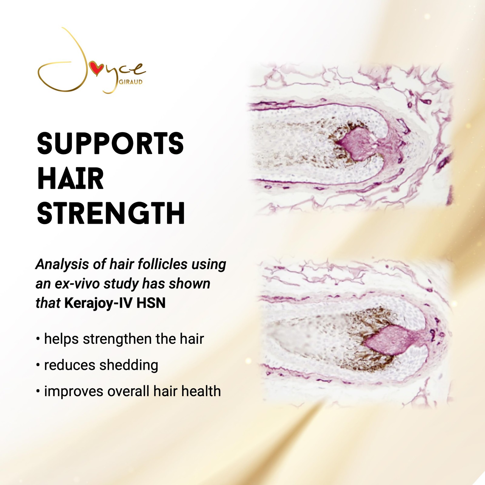 Joyce Giraud Ultimate Hair Strength Supplements 30-Day Supply, Scientifically…