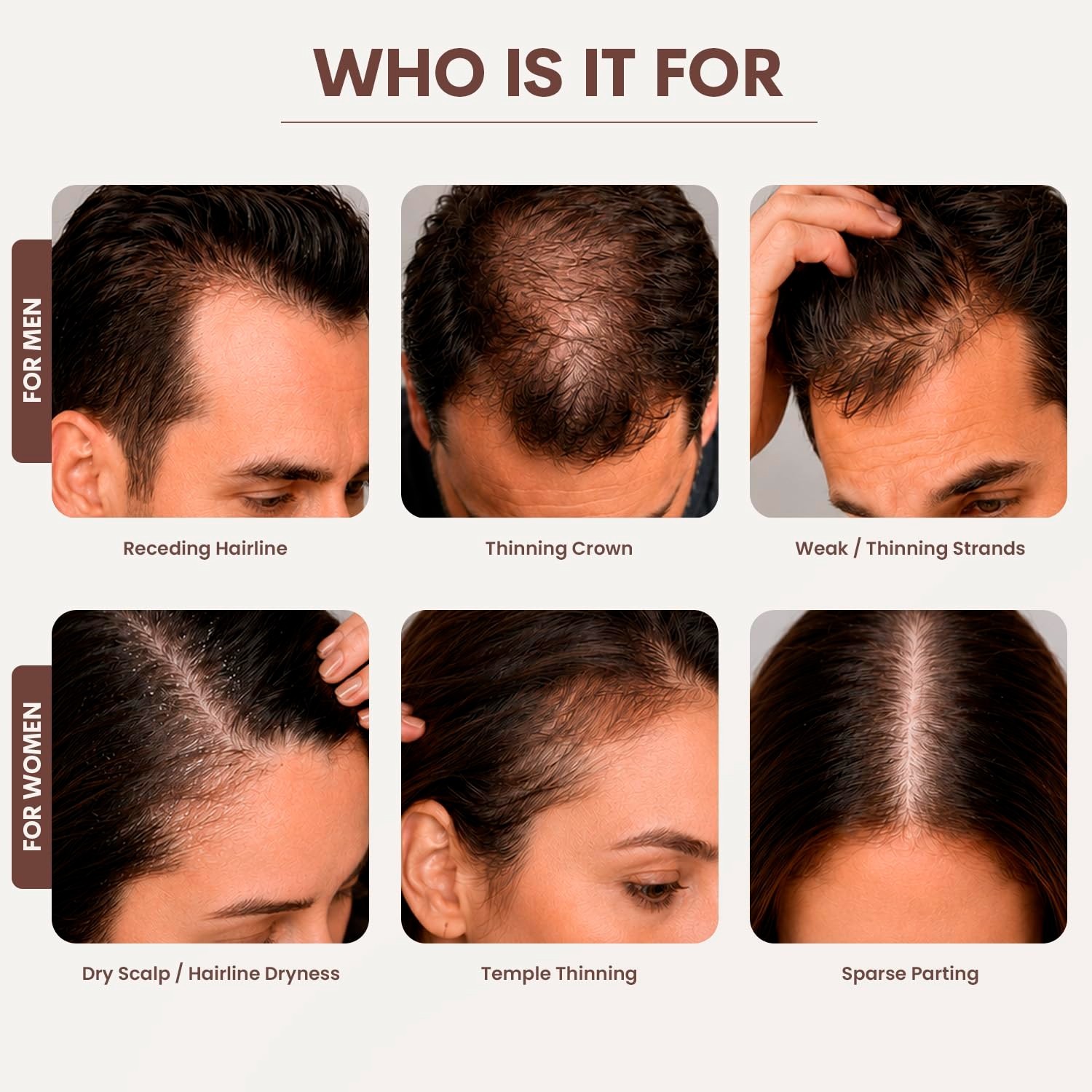SØREN Micro Infusion Hair Renewal System by SOREN – Saw Palmetto & Pe