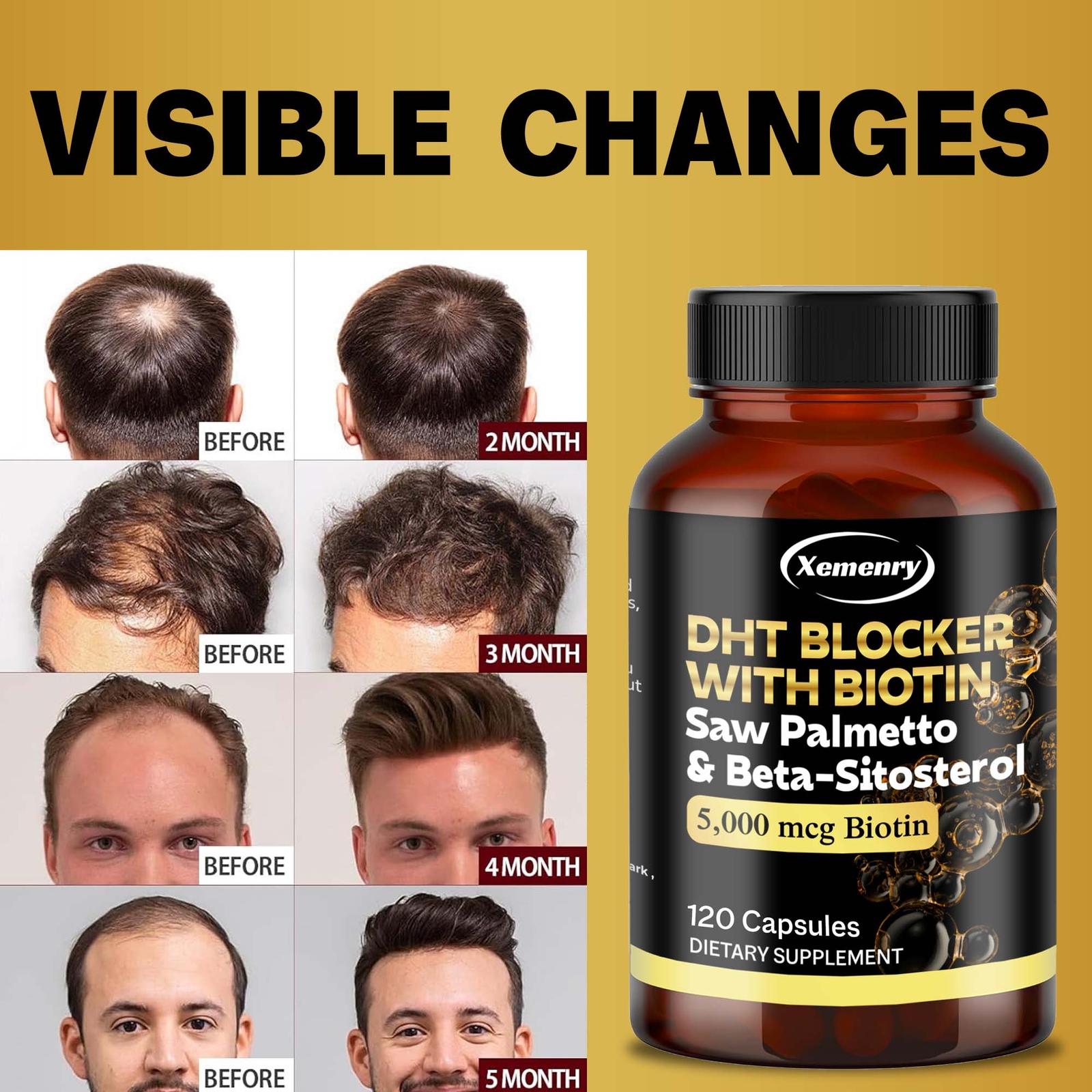 DHT Blocker Capsules – Saw Palmetto, Biotin,Beta-sitosterol – Boosts Hair Growth