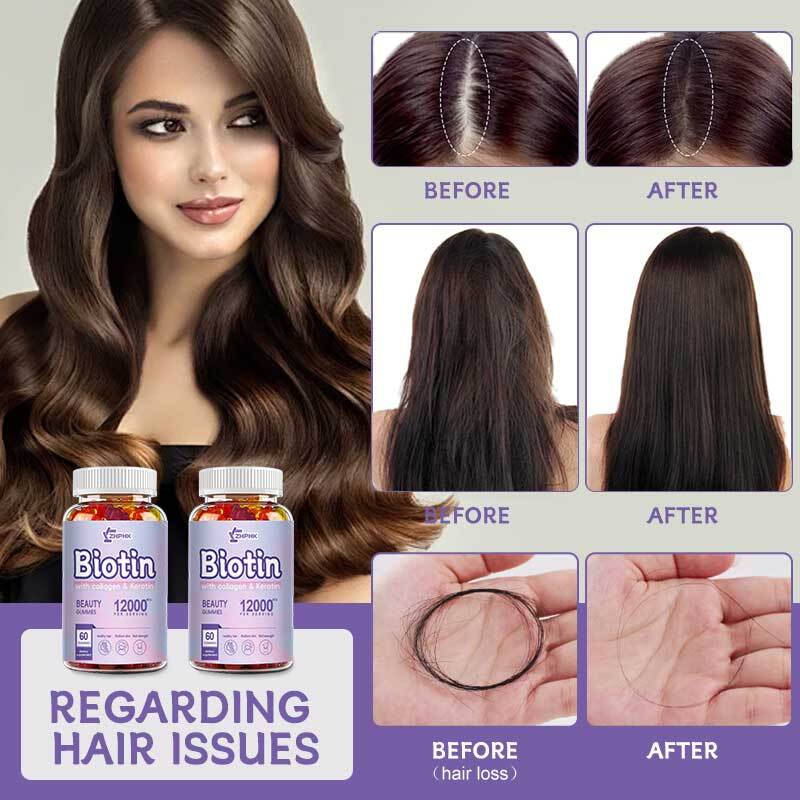 WEEM Hair Skin and Nails Gummies – Supports Healthy Hair – Vegan biotin Vitamins