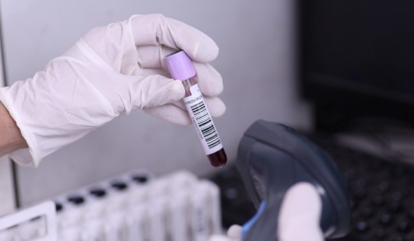 THYROID TEST Cont