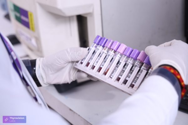THYROID TEST